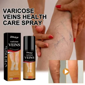 Varicose Vein Treatment Spray