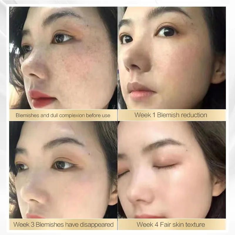 Chalonese Brightening Cream - Image 6