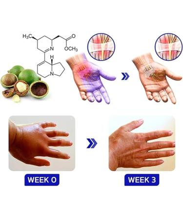 Numbfix Hand and Foot spray - Image 2
