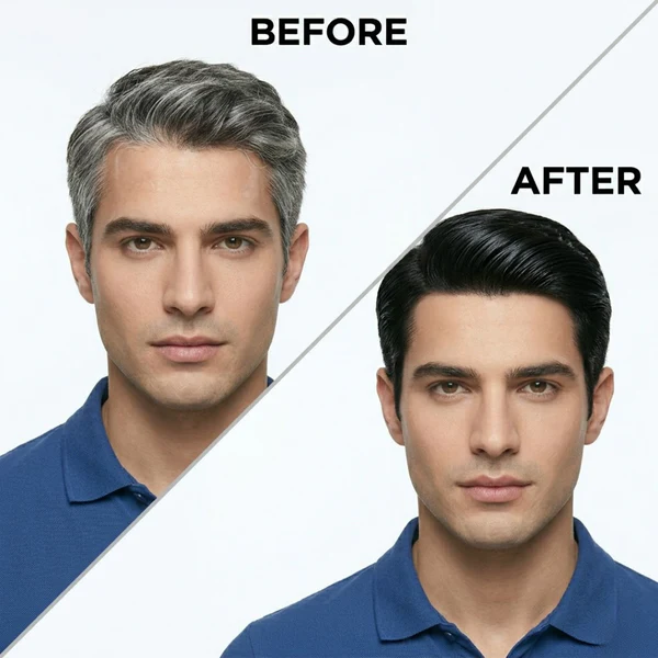 Proskire Anti Grey Hair Serum | Restores Natural Hair Color, Stimulates Pigment Cells, Reduces Grey Hair in 4 Weeks – For Men & Women - Image 7