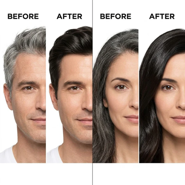 Proskire Anti Grey Hair Serum | Restores Natural Hair Color, Stimulates Pigment Cells, Reduces Grey Hair in 4 Weeks – For Men & Women - Image 3
