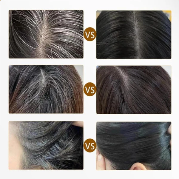 Proskire Anti Grey Hair Serum | Restores Natural Hair Color, Stimulates Pigment Cells, Reduces Grey Hair in 4 Weeks – For Men & Women - Image 4
