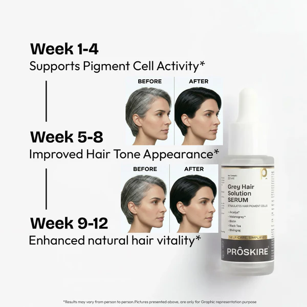 Proskire Anti Grey Hair Serum | Restores Natural Hair Color, Stimulates Pigment Cells, Reduces Grey Hair in 4 Weeks – For Men & Women - Image 8